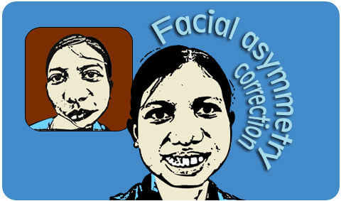 Facial asymmetry correction surgeon in India