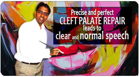 cleft-palate-repair treatment in India