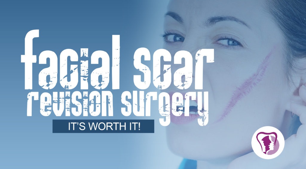 facial scar revision surgery