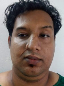 After Scar removal treatment in India