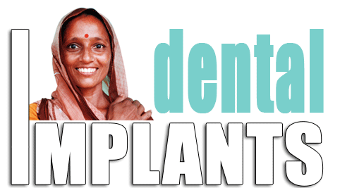 Artificial Tooth Implants in India