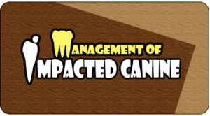 Canine tooth implant
