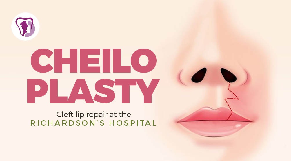 Cheiloplasty surgery in nagercoil