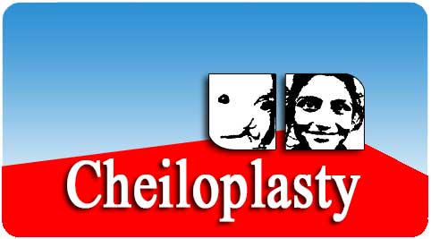 Cheiloplasty surgery treatment in India