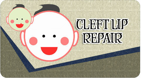Cleft lip repair surgery in Tamil Nadu