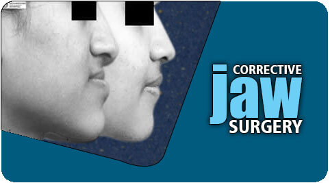 Corrective jaw surgery in Tamil Nadu