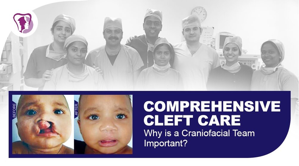 Craniofacial surgery in Nagercoil