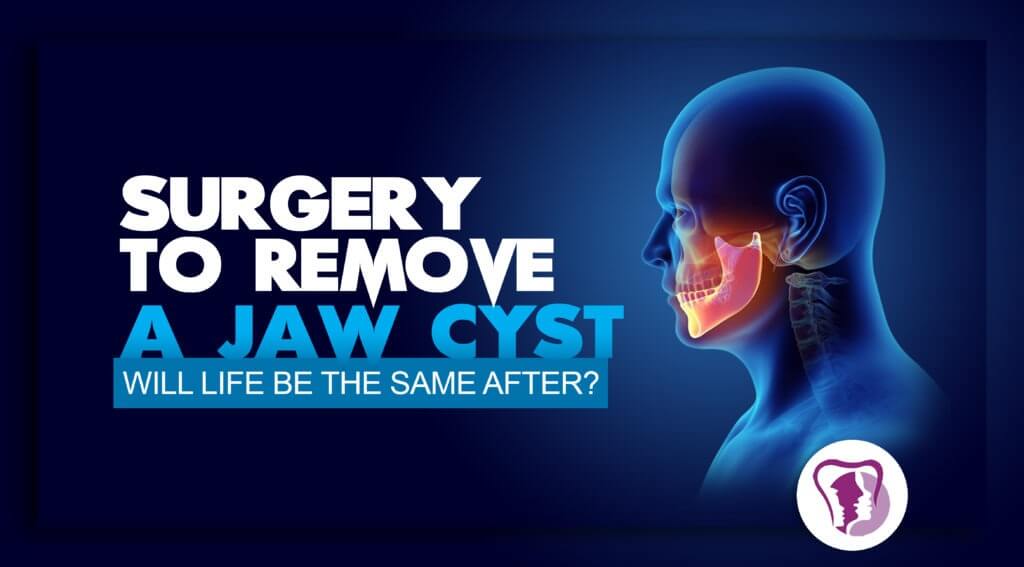 Dental cysts removal surgery