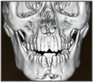 maxillofacial surgeon in nagercoil
