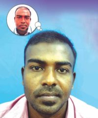 Hair Transplant Treatment in Nagercoil