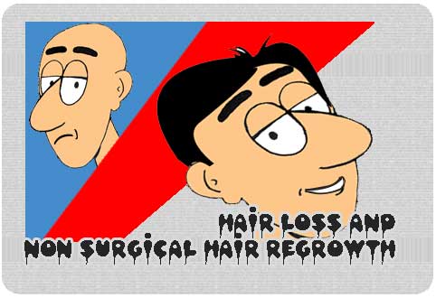 Hair loss and non surgical hair regrowth