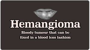 Hemangioma Treatment in Tamil Nadu