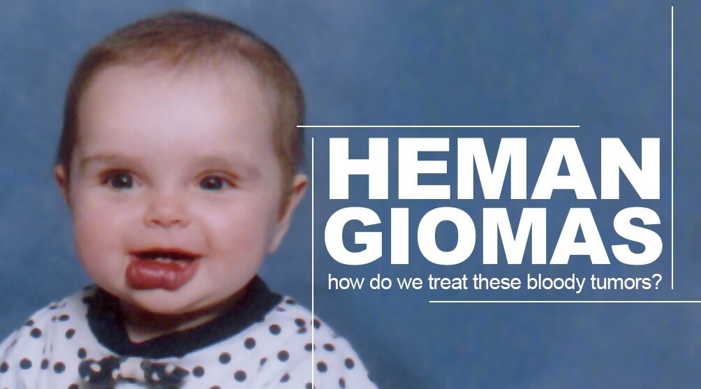 Hemangiomas treatment in India