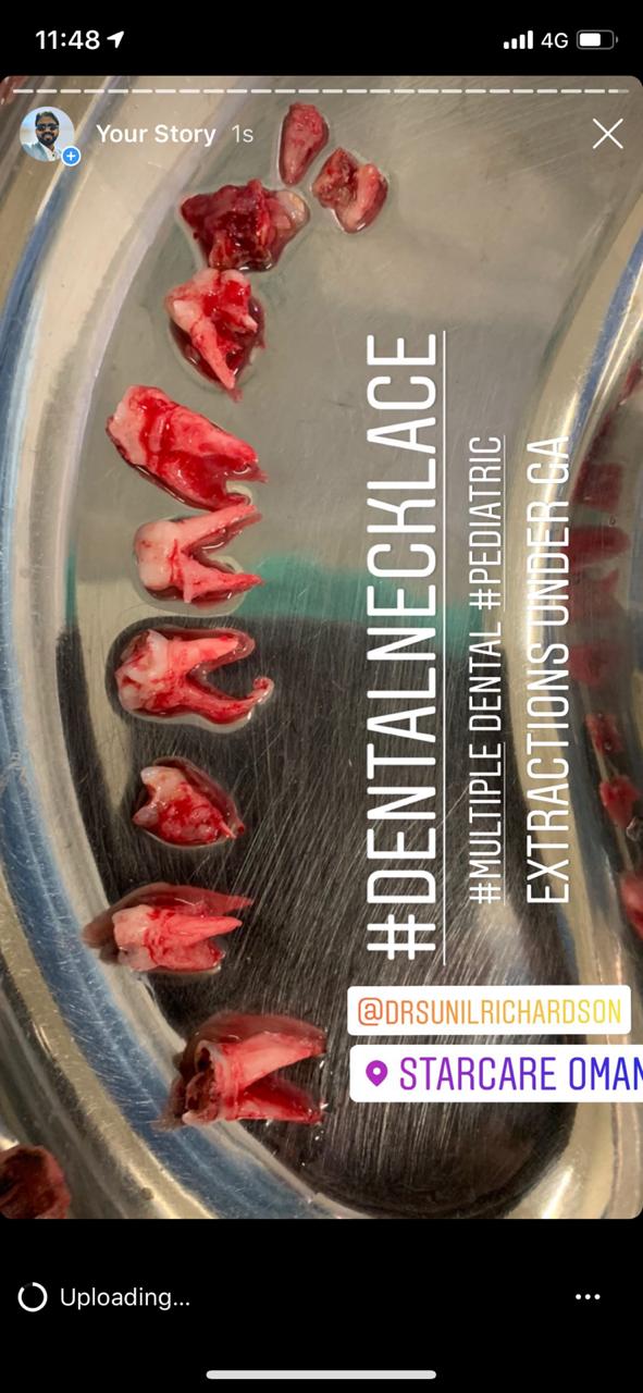 Instagram Reviews Dental Necklace