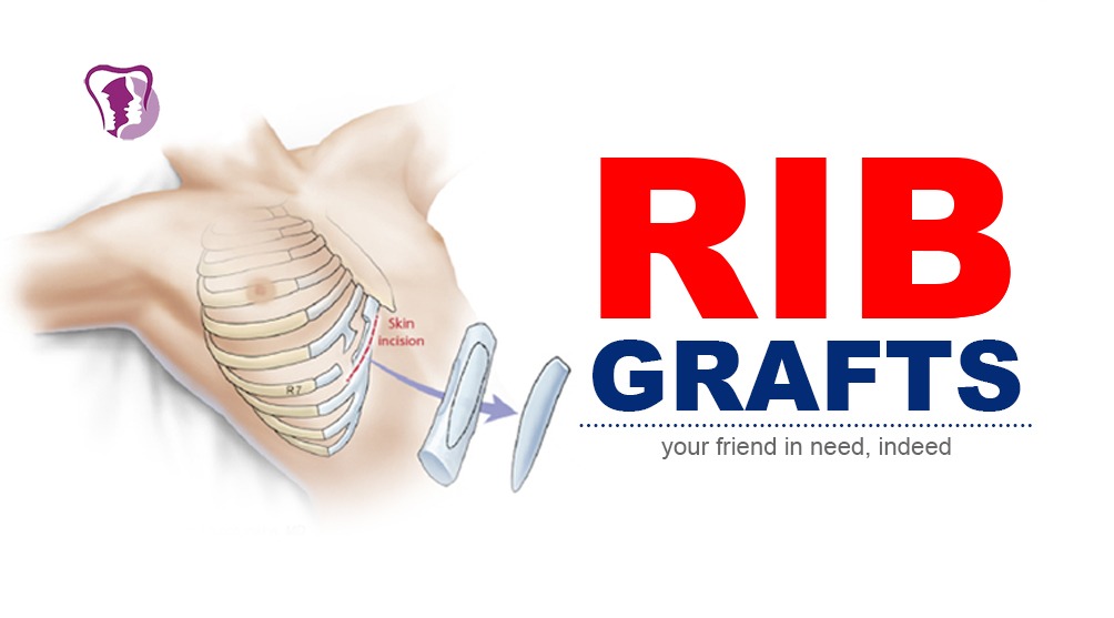 Rib grafts surgery in Richardson Hospital