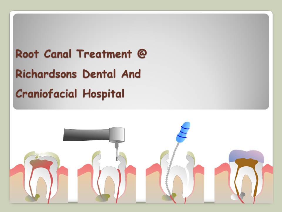 Root Canal Treatment at Richardsons Dental And Craniofacial in India