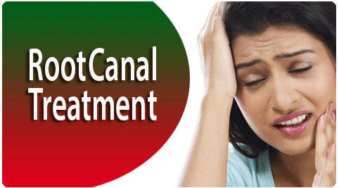Root Canal Treatment in Tamil Nadu