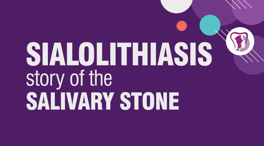 Sialolithiasis Treatment in India