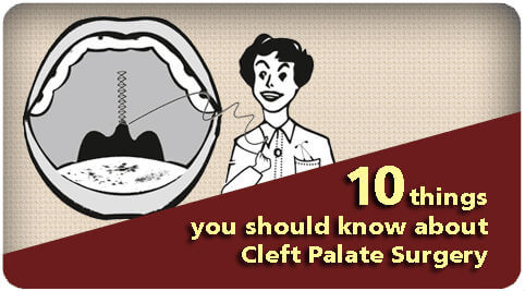 Ten things you should know about Cleft Palate