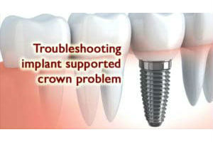 Troubleshooting Implant Supported Crown Problem treatment in India
