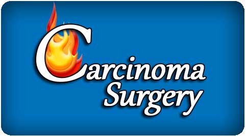 carcinoma surgeon in India
