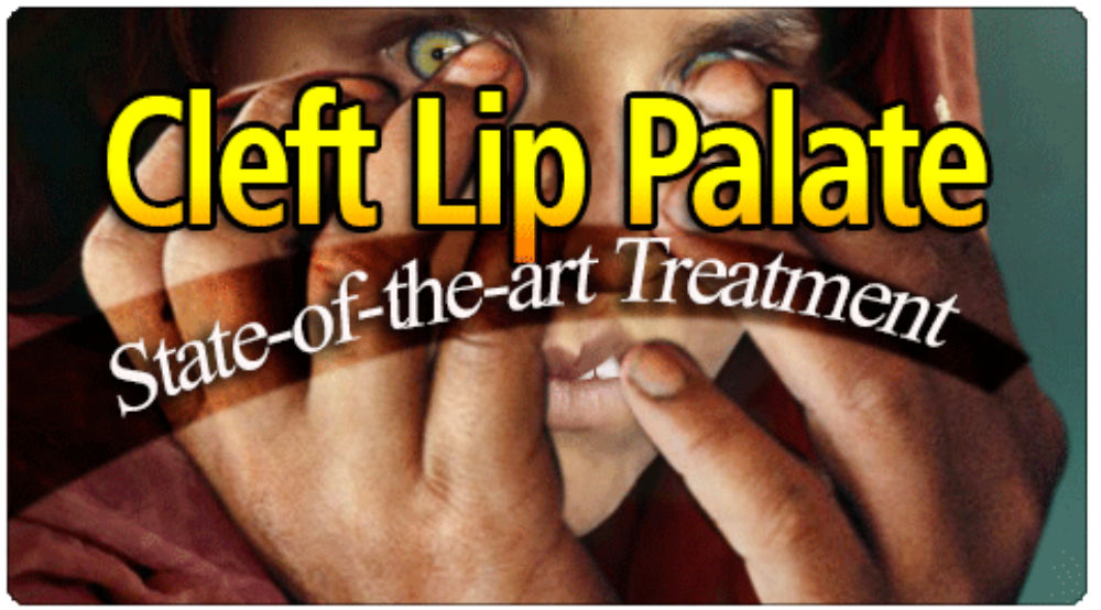 cleft lip palate state of the art treatment