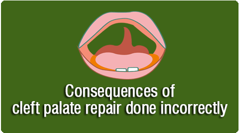 consequences of incorrect cleft lip surgery