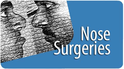 nose surgeries in India