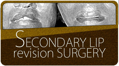 secondary lip revision surgery in India