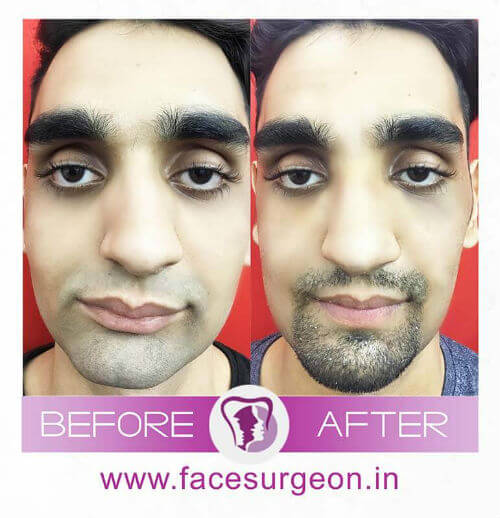 Jaw Surgery Hospital in India